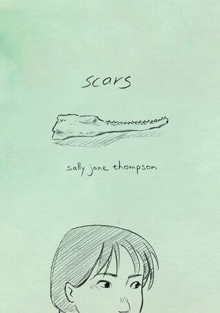 Scars