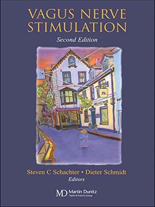 Vagus Nerve Stimulation