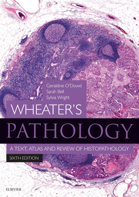 Wheater's Pathology: A Text, Atlas and Review of Histopathology E-Book (With STUDENT CONSULT Online Access)