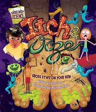 Itch & Ooze: Gross Stuff On Your Skin