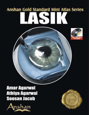 Lasik