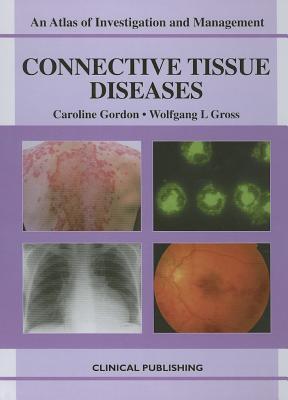 Connective Tissue Diseases: An Atlas of Investigation and Management