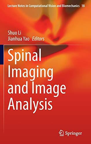 Spinal Imaging and Image Analysis