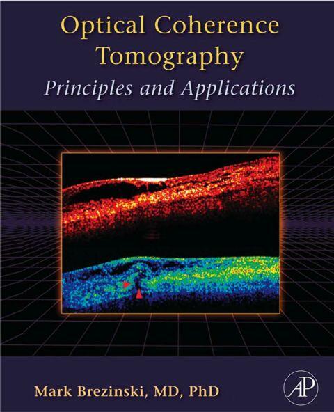 Optical Coherence Tomography: Principles and Applications