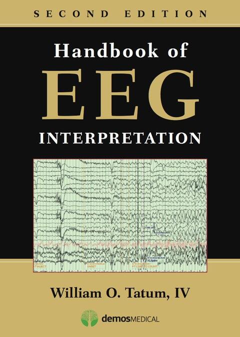 Handbook of EEG Interpretation, Second Edition