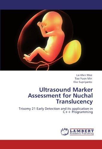 Ultrasound Marker Assessment for Nuchal Translucency: Trisomy 21 Early Detection and Its Application in C++ Programming