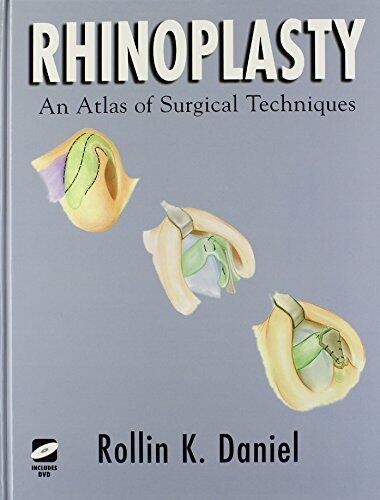 Rhinoplasty: An Atlas of Surgical Techniques