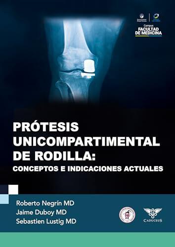 Prótesis unicompartimental de rodilla: Conceptos e indicaciones actuales