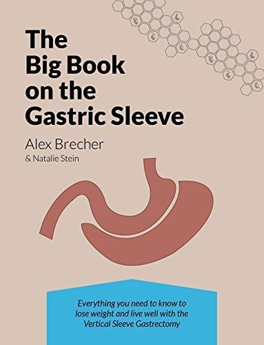 The BIG Book on the Gastric Sleeve: Everything You Need To Know To Lose Weight and Live Well with the Vertical Sleeve Gastrectomy