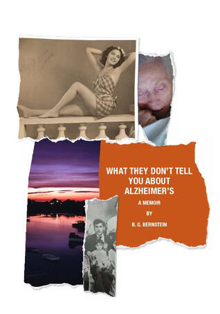 What They Don't Tell You About Alzheimer's