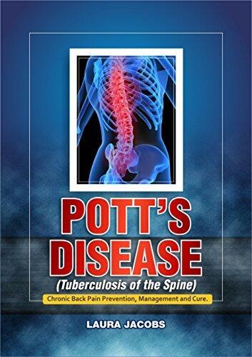 Pott's Disease (Tuberculosis of the Spine): Chronic Back pain Prevention, Management And Cure