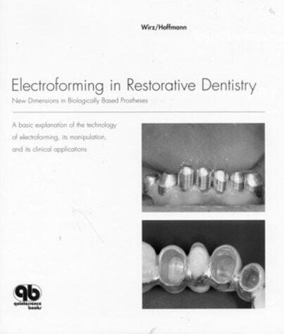Electroforming in Restorative Dentistry: New Dimensions in Biologically Based Prostheses
