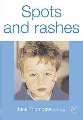 Spots and Rashes
