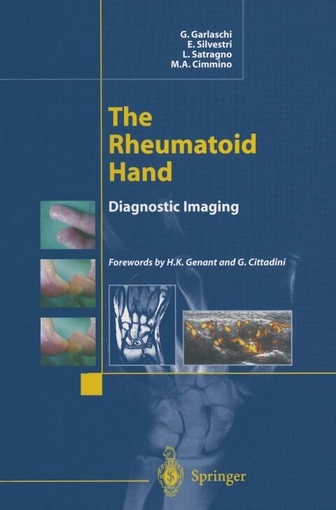The Rheumatoid Hand: Diagnostic Imaging