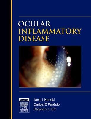 E-Book - Ocular Inflammatory Disease