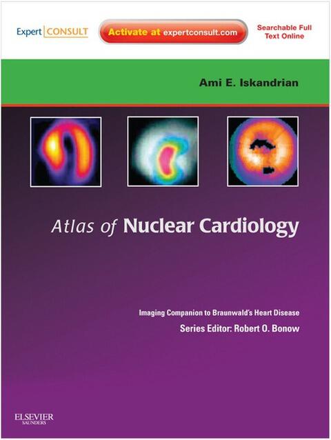Atlas of Nuclear Cardiology: Imaging Companion to Braunwald's Heart Disease (E-Book): Expert Consult - Online and Print