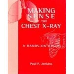 Making Sense of the Chest X-Ray Ise a Hands-on Guide