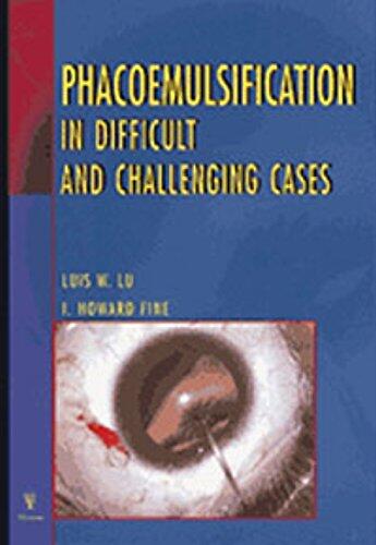 Phacoemulsification in Difficult and Challenging Cases