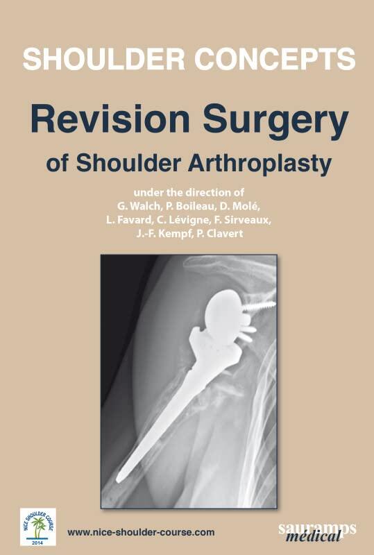 Shoulder Concepts: Revision Surgery of Shoulder Arthroplasty 2014