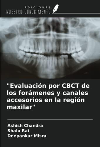 Evaluación por CBCT de los Forámenes y Canales Accesorios en la Región Maxilar