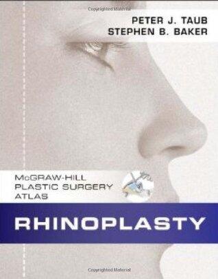 Rhinoplasty
