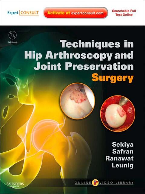 Techniques in Hip Arthroscopy and Joint Preservation: Expert Consult