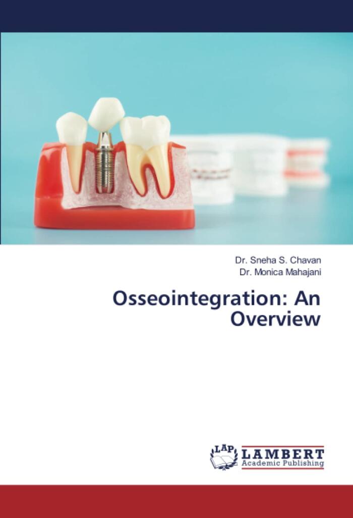 Osseointegration: An Overview