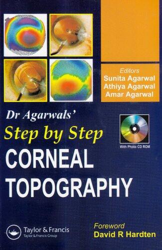 Step by Step Corneal Topography