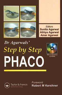 Step by Step Phacoemulsification