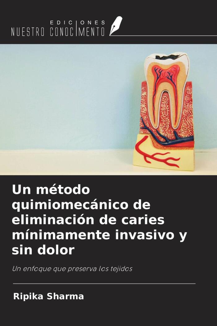Un Método Quimiomecánico de Eliminación de Caries Mínimamente Invasivo y Sin Dolor: Un Enfoque que Preserva los Tejidos