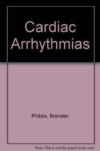 Cardiac Arrhythmias by Brendan Phibbs