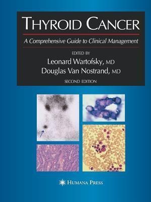 Thyroid Cancer: A Comprehensive Guide to Clinical Management