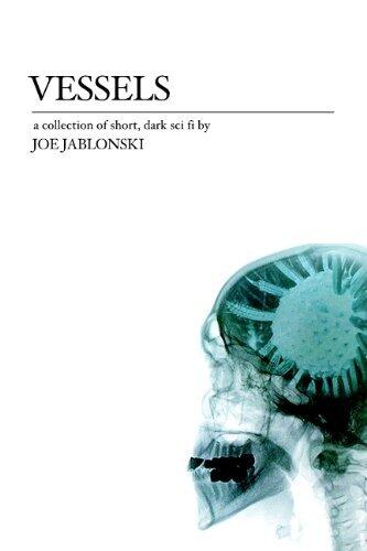 Vessels