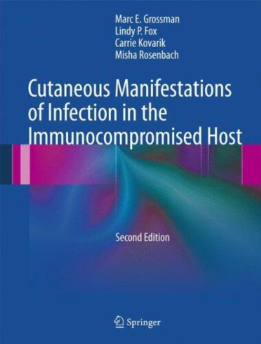 Cutaneous Manifestations of Infection in the Immunocompromised Host (2nd Edition 2012)