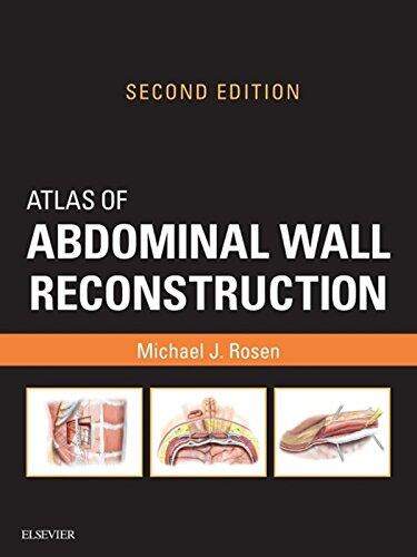 Atlas of Abdominal Wall Reconstruction (E-Book): Expert Consult (Online and Print)