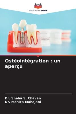 Ostéointégration : un aperçu