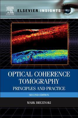 Optical Coherence Tomography, Second Edition: Principles and Practice
