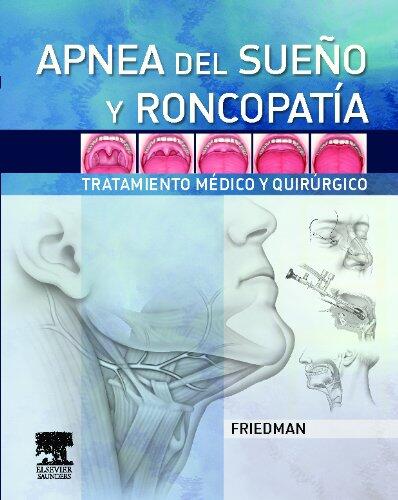 Apnea del Sueño y Roncopatía