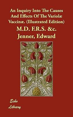 An Inquiry into the Causes and Effects of the Variolae Vaccinae
