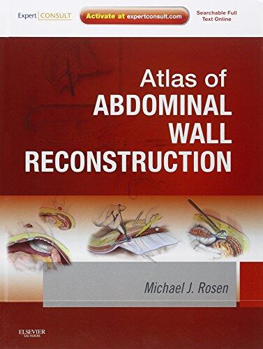 Atlas of Abdominal Wall Reconstruction: Expert Consult (Online and Print)