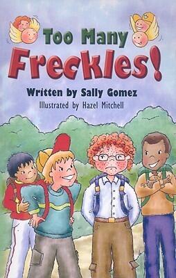 Too Many Freckles