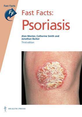 Fast Facts: Psoriais, 3rd edition