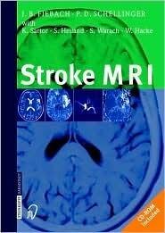 Stroke MRI
