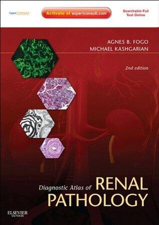 Diagnostic Atlas of Renal Pathology: Expert Consult (Online and Print)