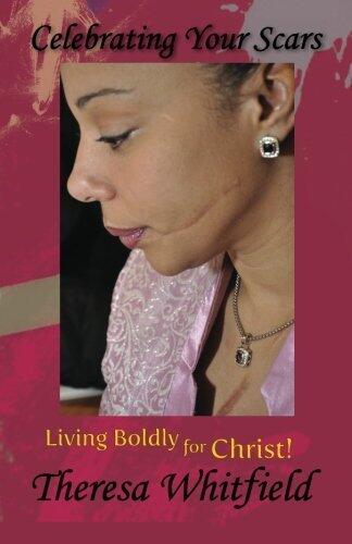 Celebrating Your Scars: Living Boldly for Christ