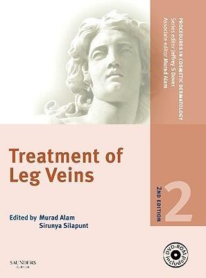 Procedures in Cosmetic Dermatology Series: Treatment of Leg Veins