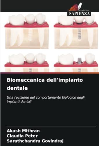 Biomeccanica dell'impianto dentale: Una revisione del comportamento biologico degli impianti dentali