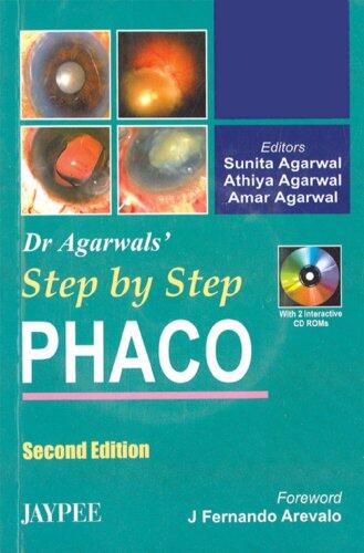 Dr. Agarwal's Step by Step Phaco with 2 Interactive CD-ROMs