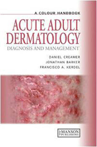 Acute Adult Dermatology: Diagnosis and Management: A Colour Handbook
