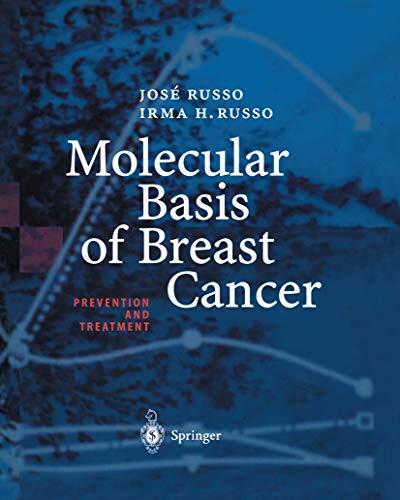 Molecular Basis of Breast Cancer (Prevention and Treatment)